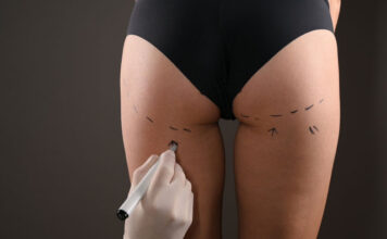 Powiększanie pośladków - Klinika Genesis