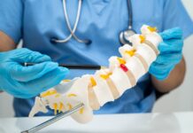 Operacja przepukliny kręgosłupa – wskazania, przebieg i rehabilitacja Operacja przepukliny kręgosłupa