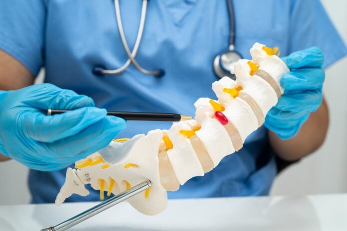 Operacja przepukliny kręgosłupa